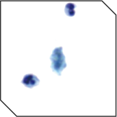 TRI