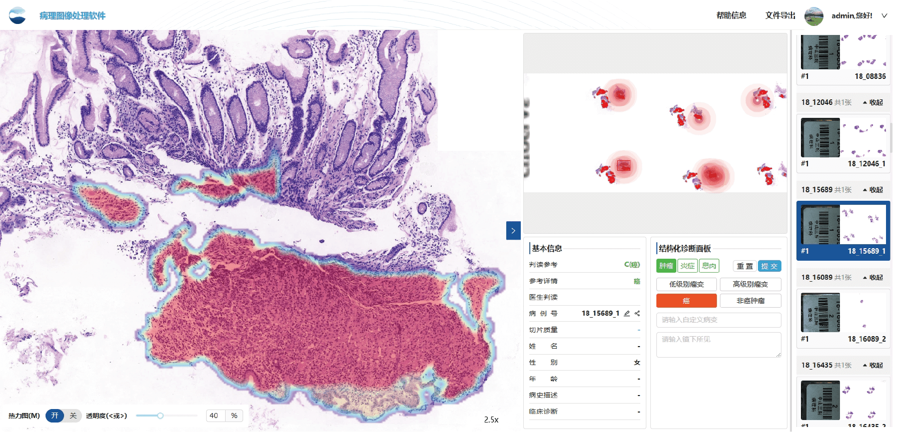 stomach_tissue